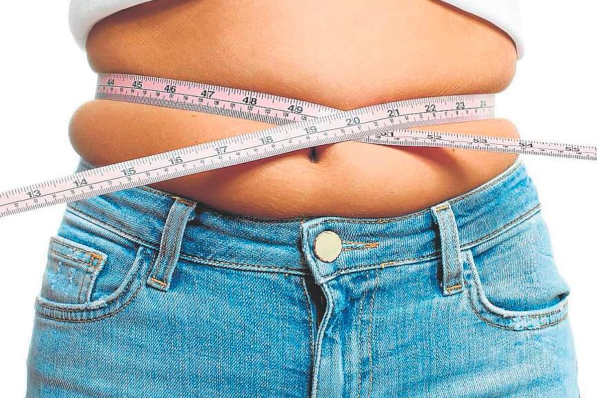 Sobrepeso y obesidad: estas son las cirugías más comunes para adelgazar