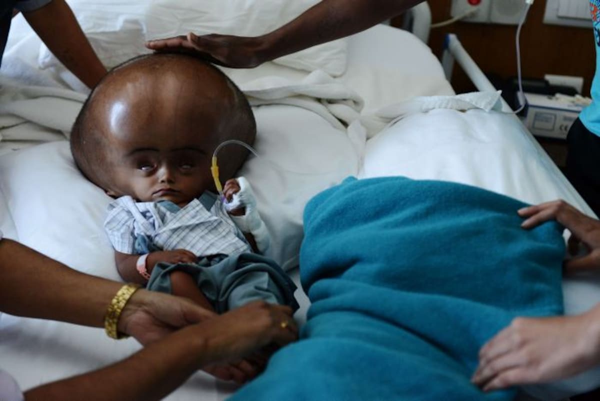 Roona Begum tiene 15 meses de edad. AFP ROBERTO SCHMIDT