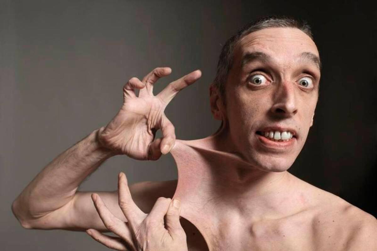 15 de mayo: día mundial para visibilizar tres enfermedades raras