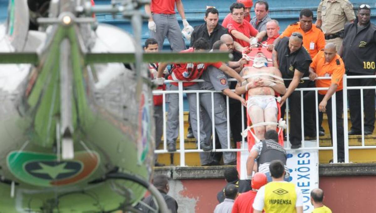 Una persona resultó herido durante partido del Atlético Paranaense Vs Vasco da Gama. AP Carlos Moraes