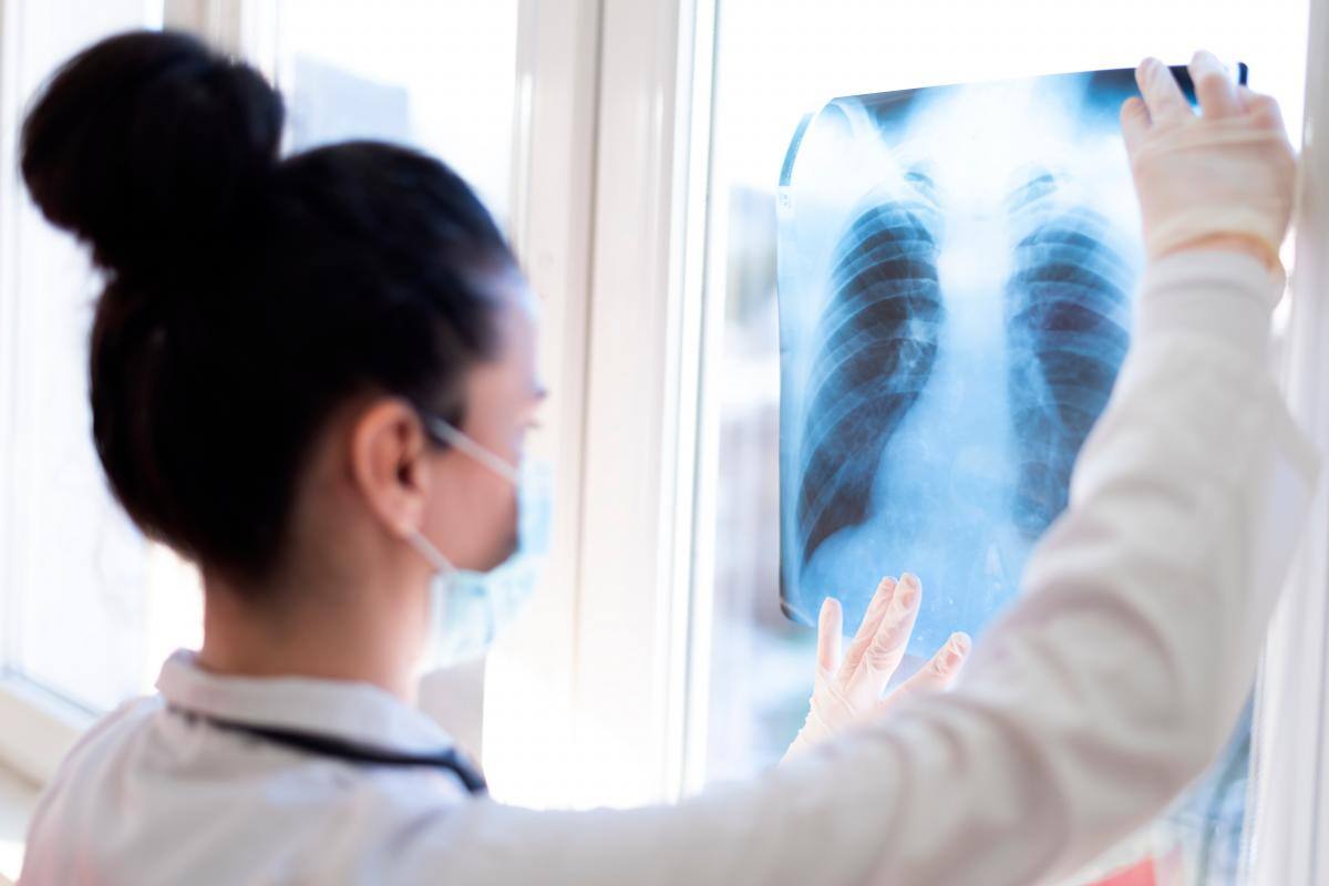 La cura universal del cáncer de pulmón podría no llegar nunca: estudio
