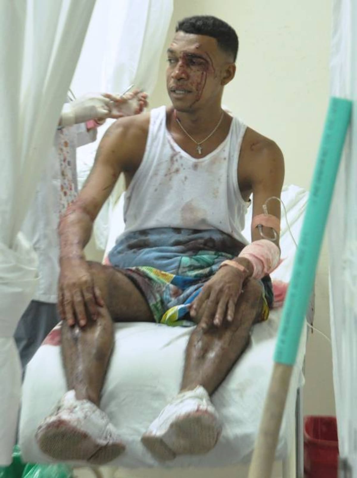 Guillermo García Herrera, recluso herido. EL UNIVERSAL
