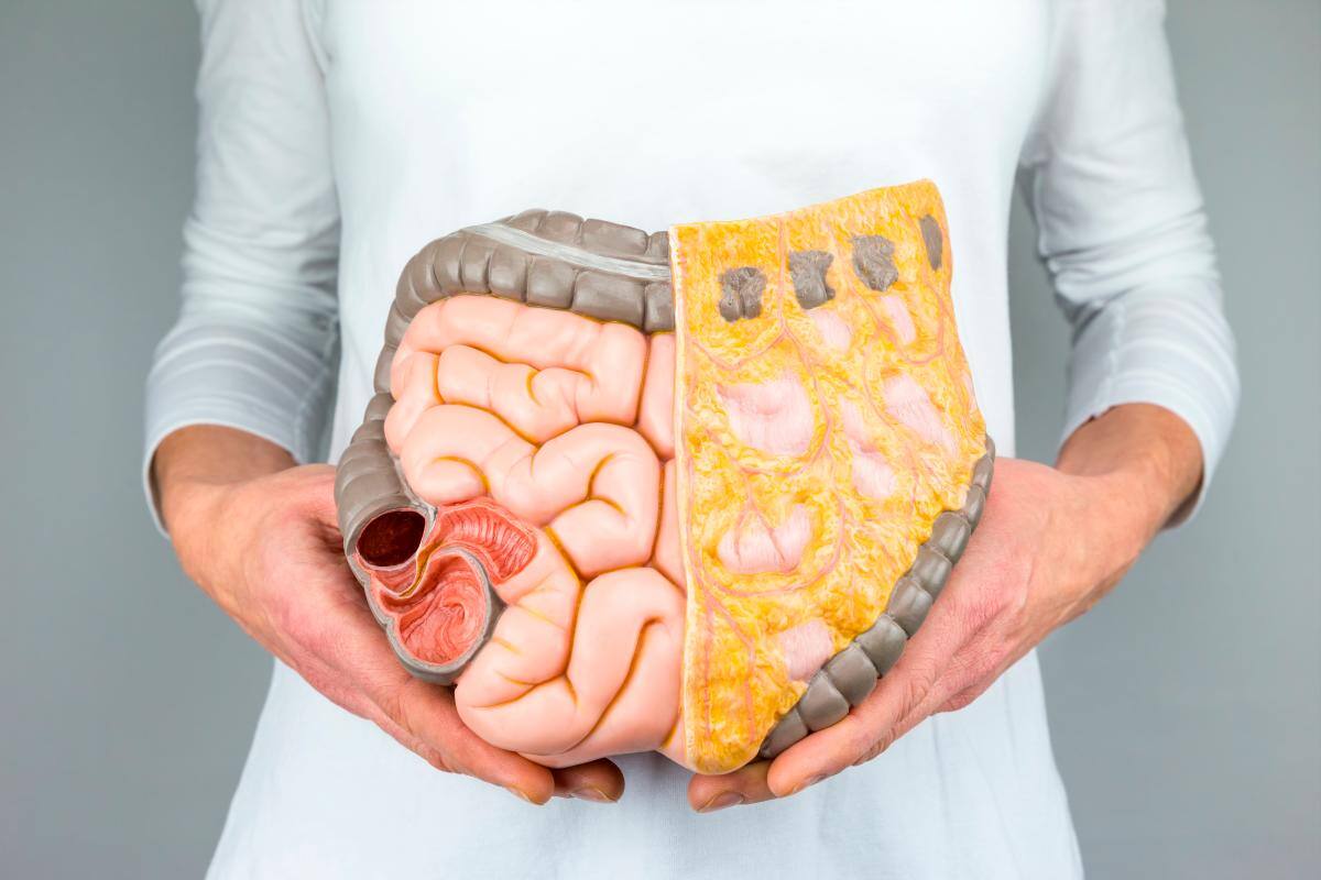 Cáncer de colon: Cómo podemos prevenirlo