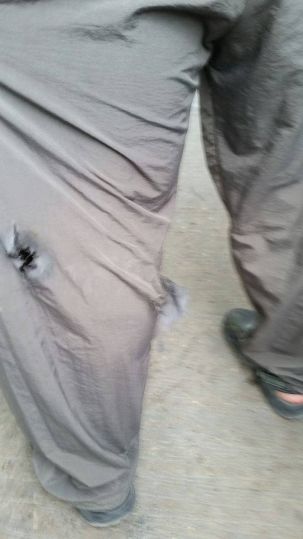 Denunció que la bala rozó su pantorrila. Cortesía