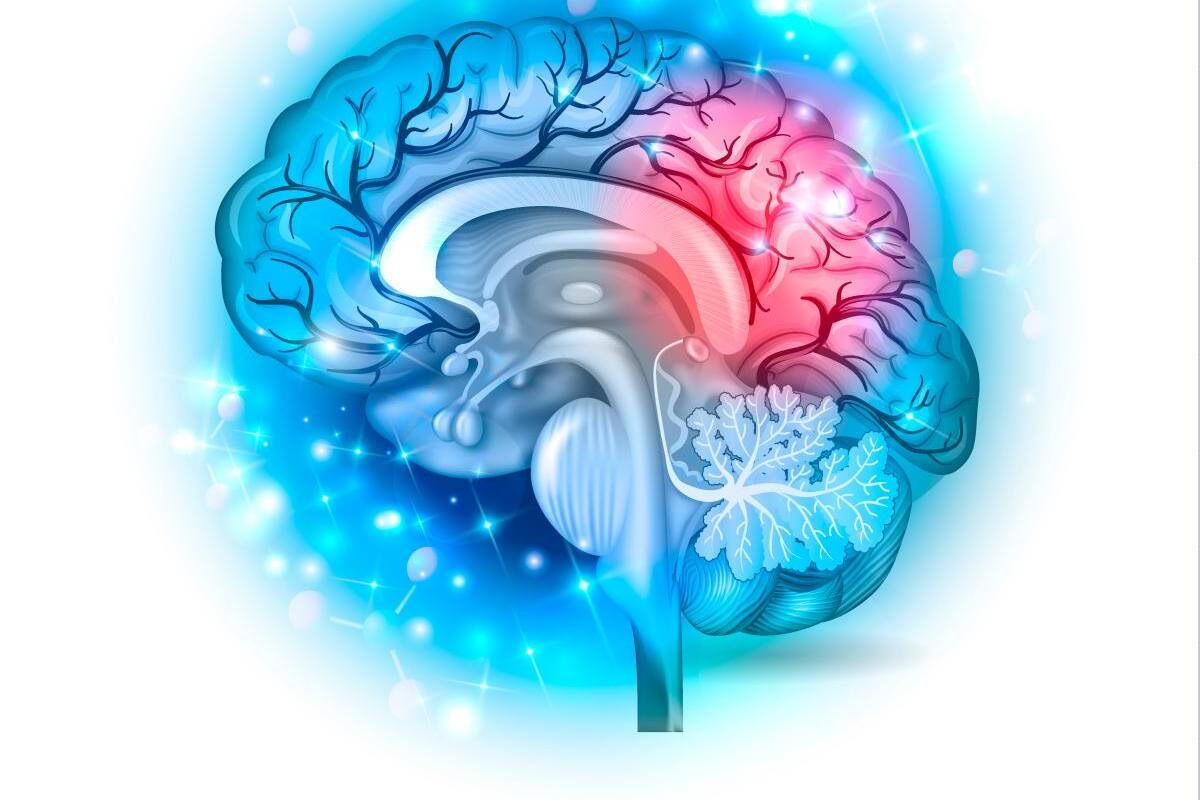 ¿Qué hay detrás de los ataques cerebrales en jóvenes?