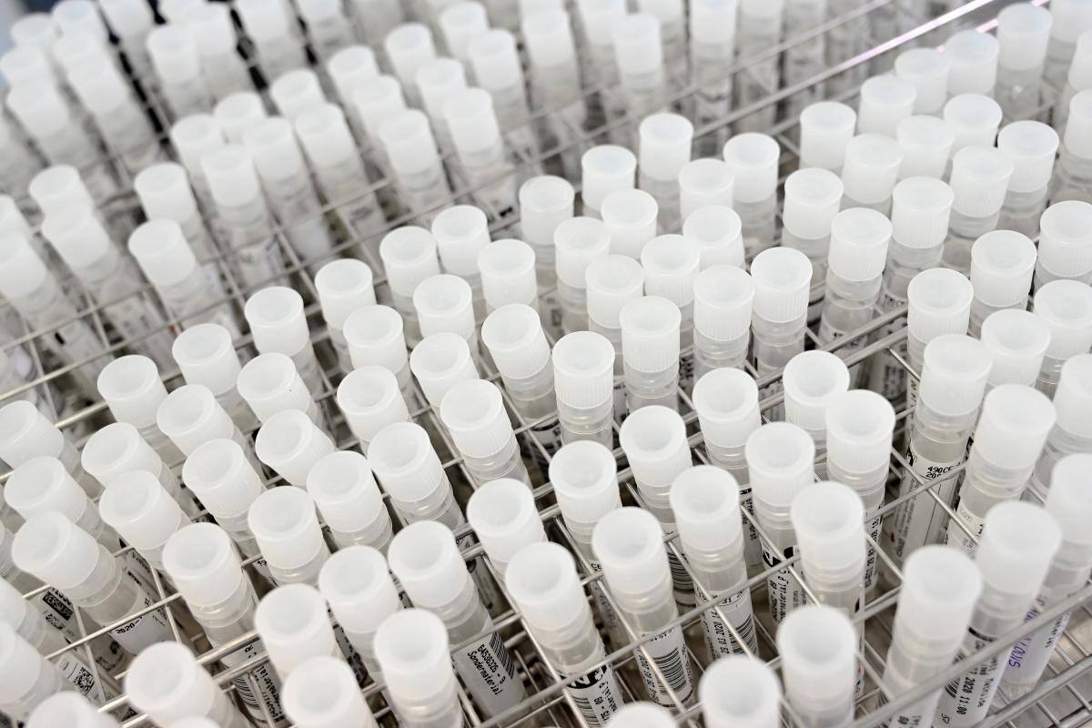 Expertos hallan conexión entre el metabolismo y tumores colorrectales