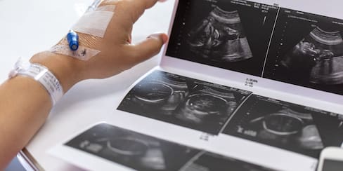 Aborto espontáneo: el duelo invisible que muchas mujeres viven en silencio