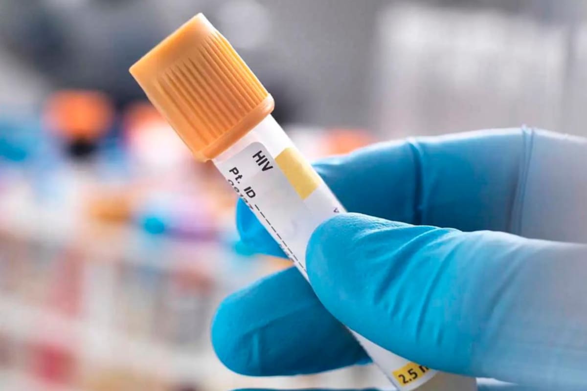 Alternativas para diagnosticar Enfermedades de Transmisión Sexual