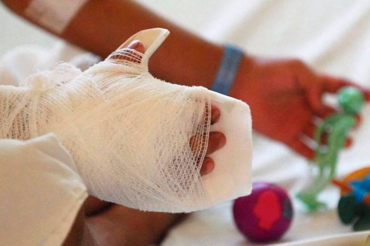 Crece cifra de quemados con pólvora en Córdoba: van 16