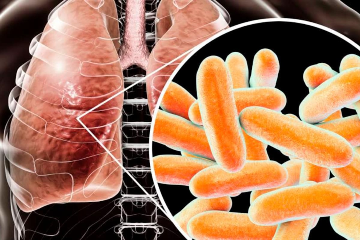 Alerta por bacteria que mató a 7 personas y tiene enfermas a otras 76