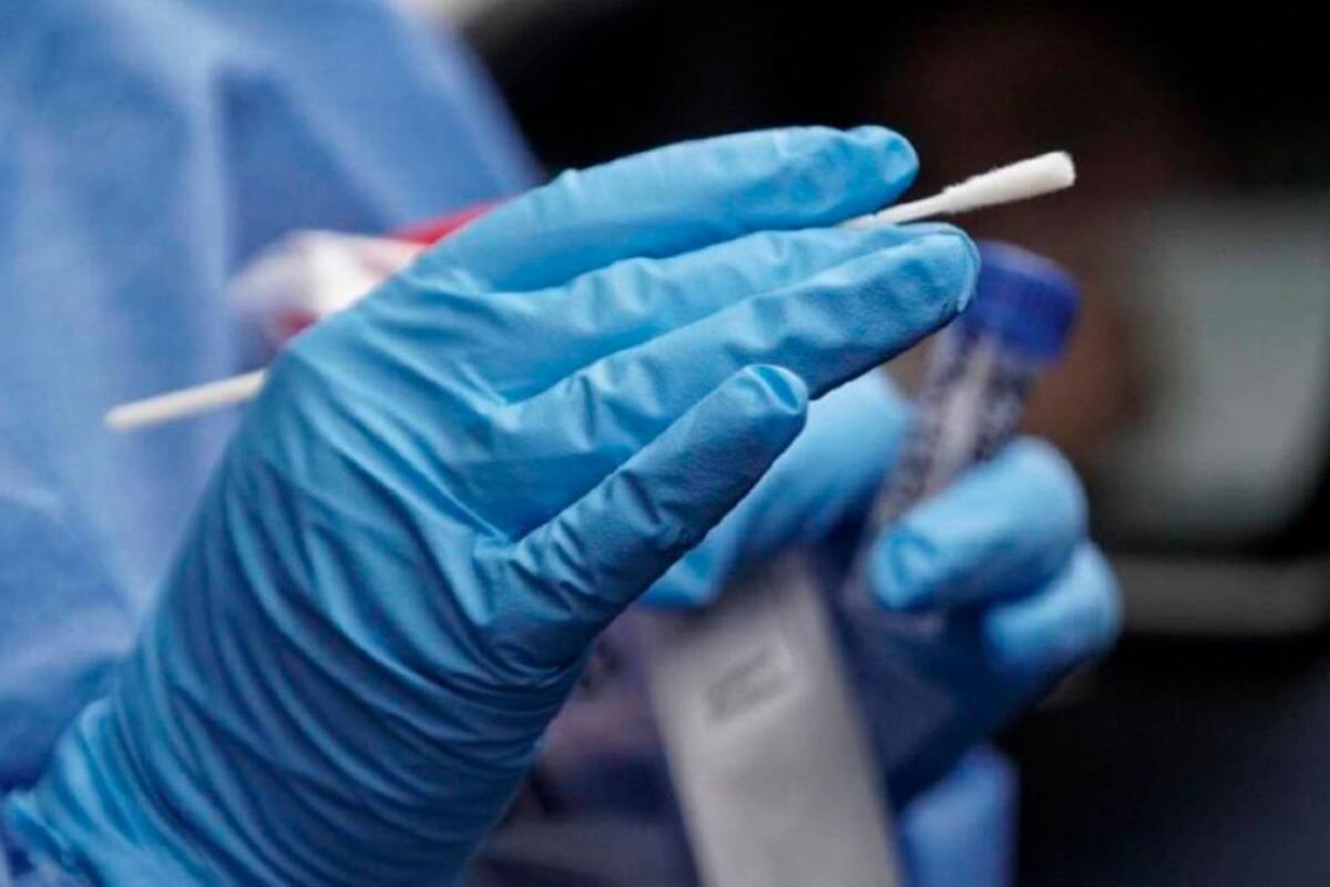 Minsalud anuncia cambios en pruebas PCR, ¿quiénes deben hacérsela?