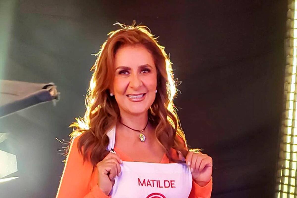 Exparticipante de MasterChef Celebrity perdió a uno de sus gemelos