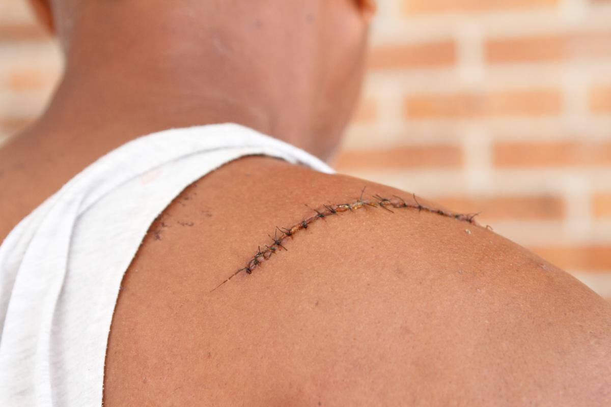 Brutal ataque a machete en casa de Loma Fresca: “querían entrar a robar”