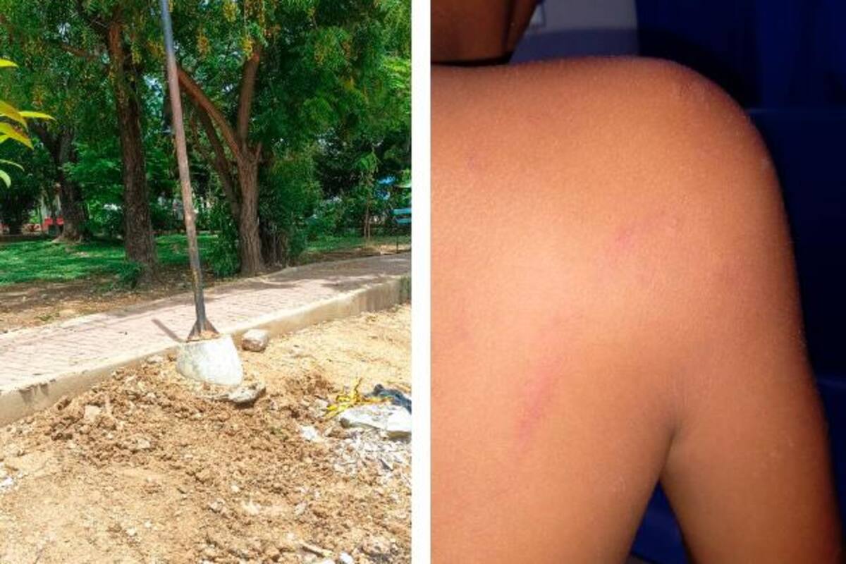 Niño sufrió descarga eléctrica al agarrar lámpara en parque, quejas por obras