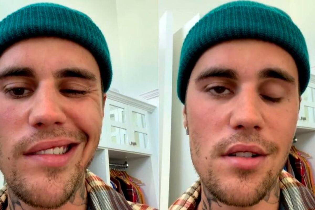 La rara enfermedad que sufre Justin Bieber