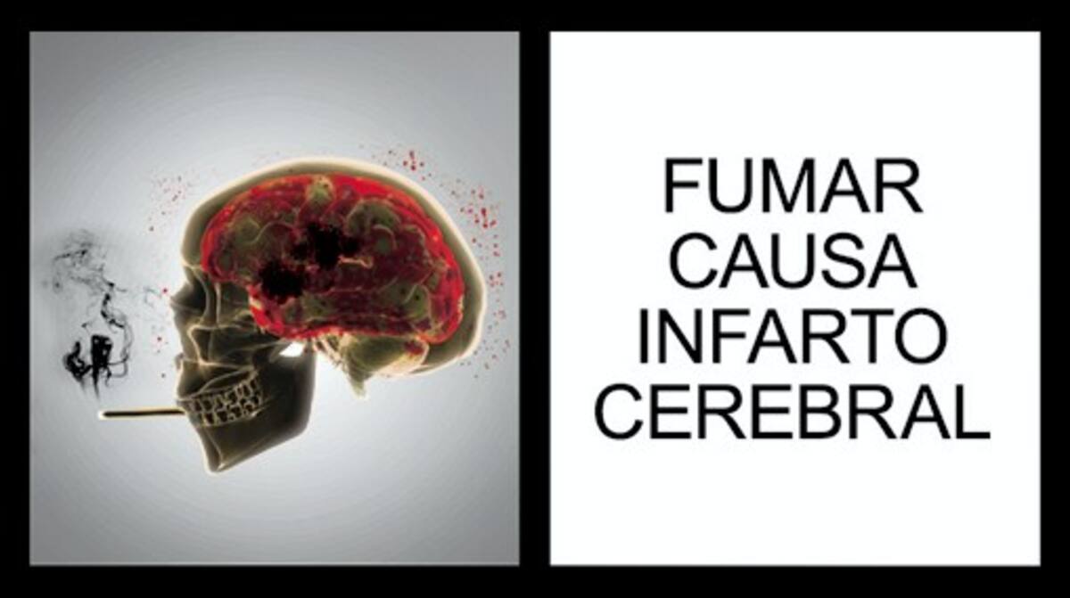 Fumar produce infartlos. Usted escoge. CORTESIA MINPROTECCION
