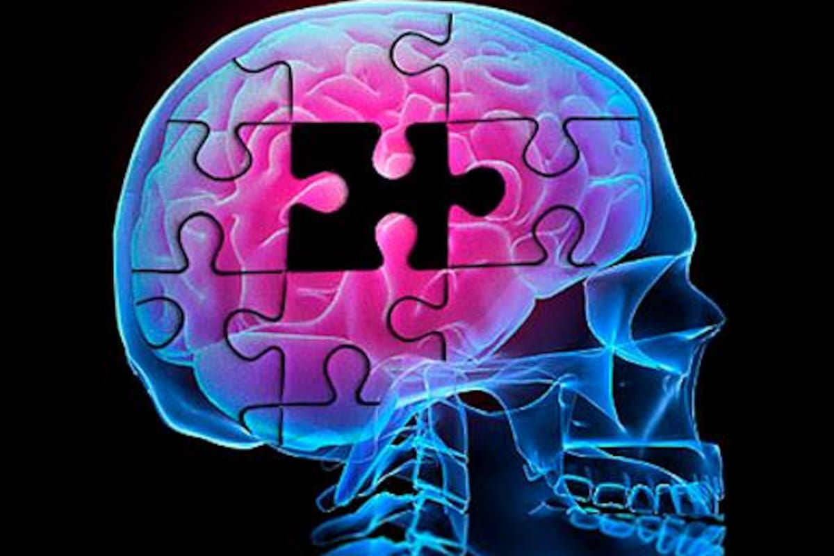 Por qué las mujeres son más susceptibles a sufrir alzheimer