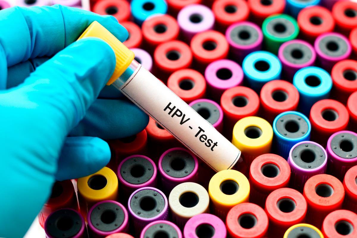 Dentro de los VPH hay varias familias, los que se asocian a progresión a cáncer que se denominan oncogénicos o de alto riesgo y los que no, que se denominan de bajo riesgo. FOTO RF123
