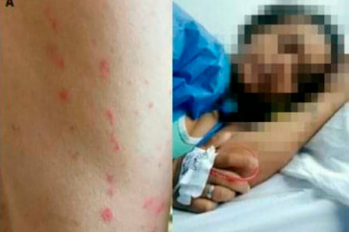 ¿Pareja fue atacada por hormigas tras noche pasional con nutella?