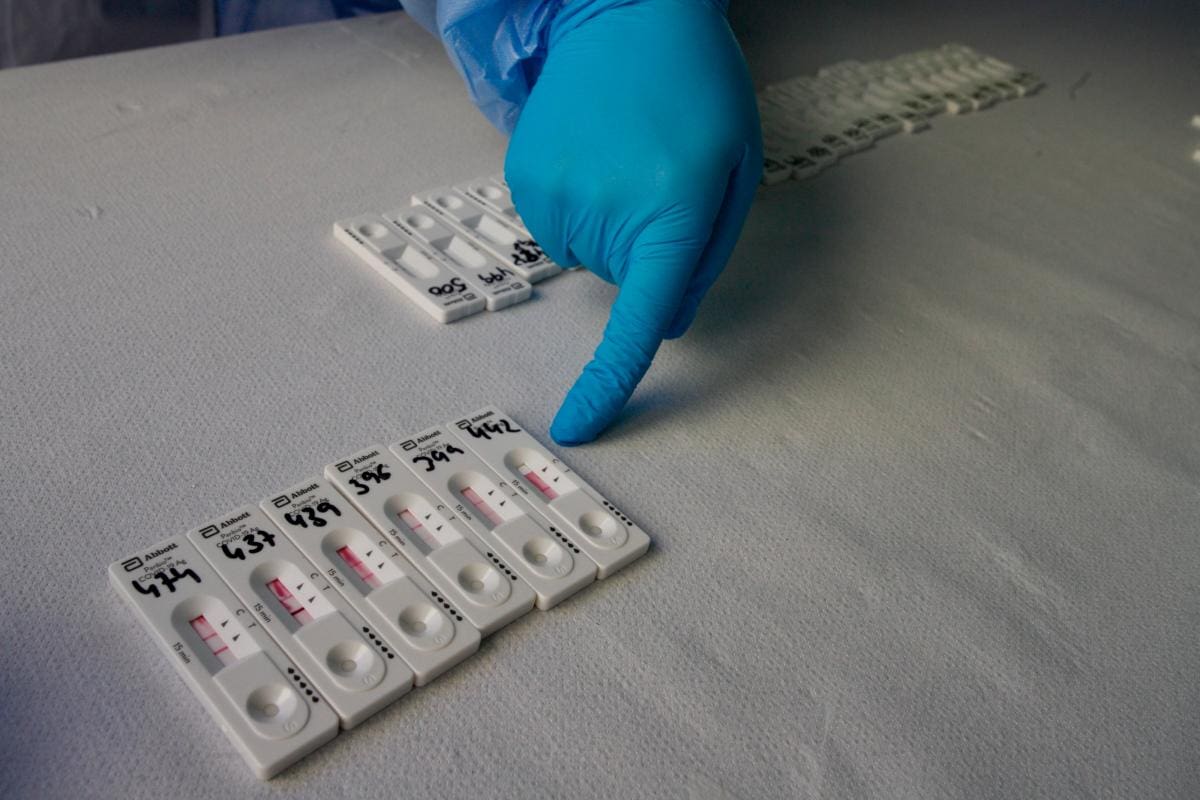 Variantes genéticas pueden interferir en la infección por COVID