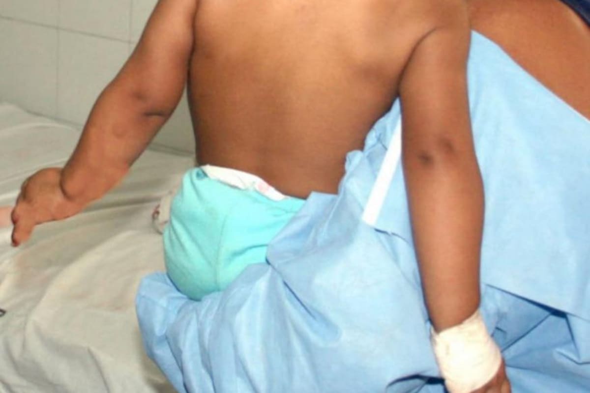 Cáncer infantil: en Sucre diagnosticaron 20 casos en el 2021