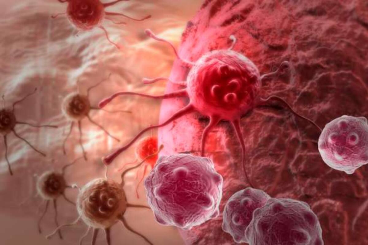 Se descubre el origen de la metástasis del cáncer