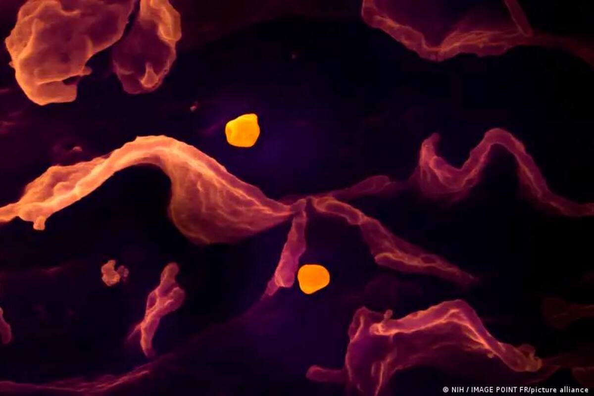 ¿Puede el brote del virus Nipah causar una nueva pandemia?