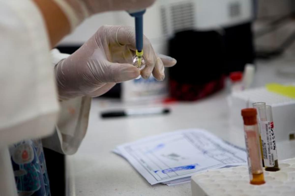 Detectan en Hong Kong el primer reinfectado de COVID-19 en el mundo
