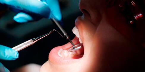 ¡Cuidado! Un tratamiento odontológico puede dejar lesiones