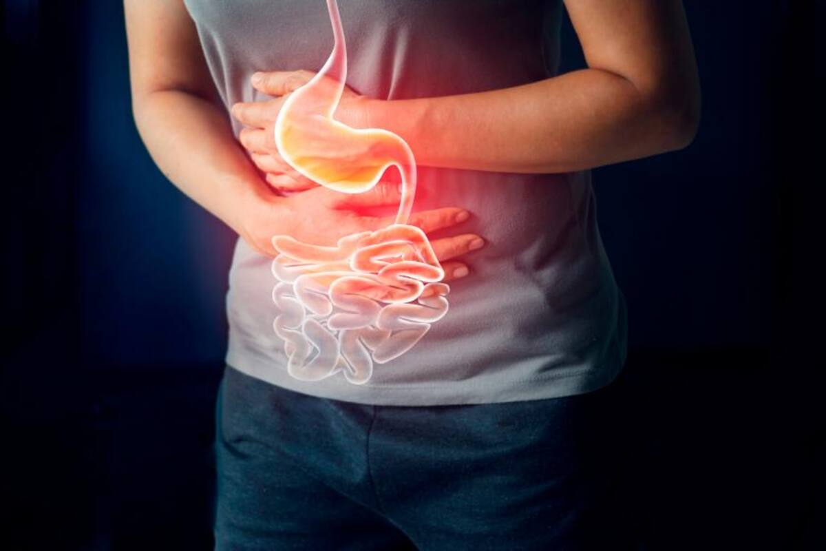 Cáncer colorrectal, el cuarto más común en el mundo