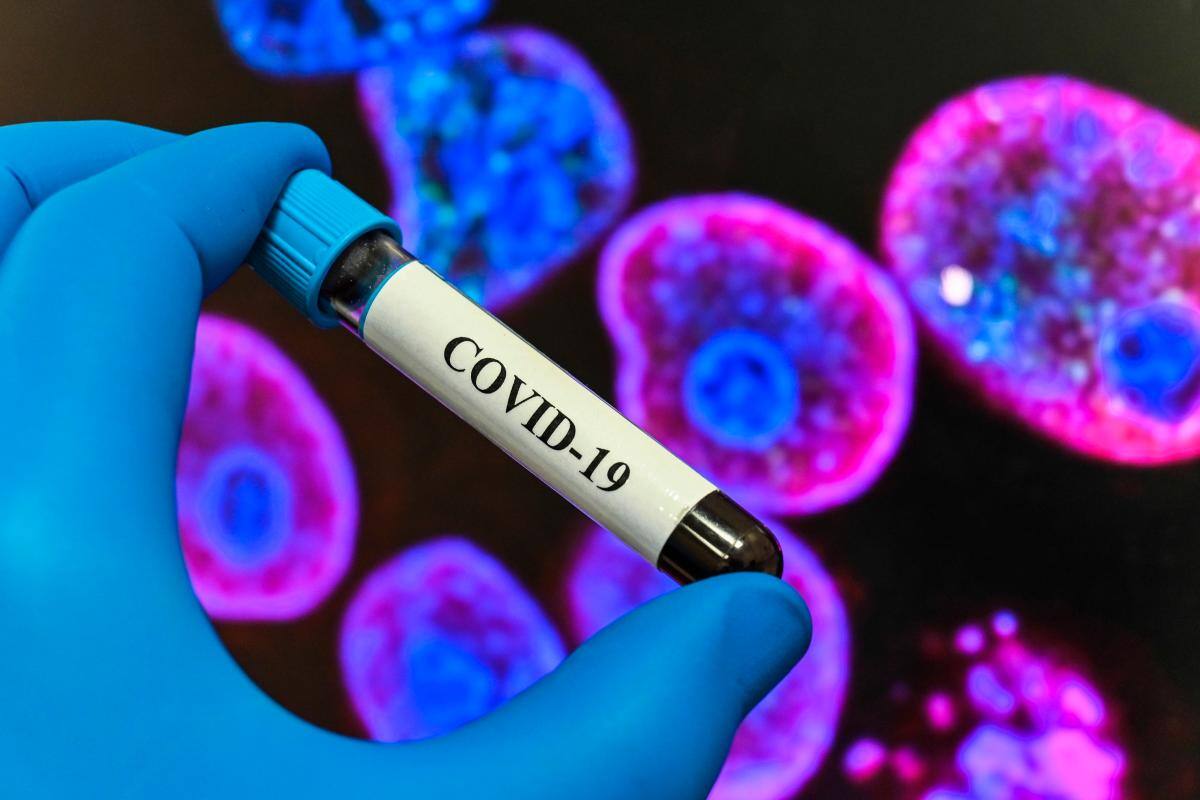 ¡No se descuide! EG.5, la subvariante más presente de COVID en China