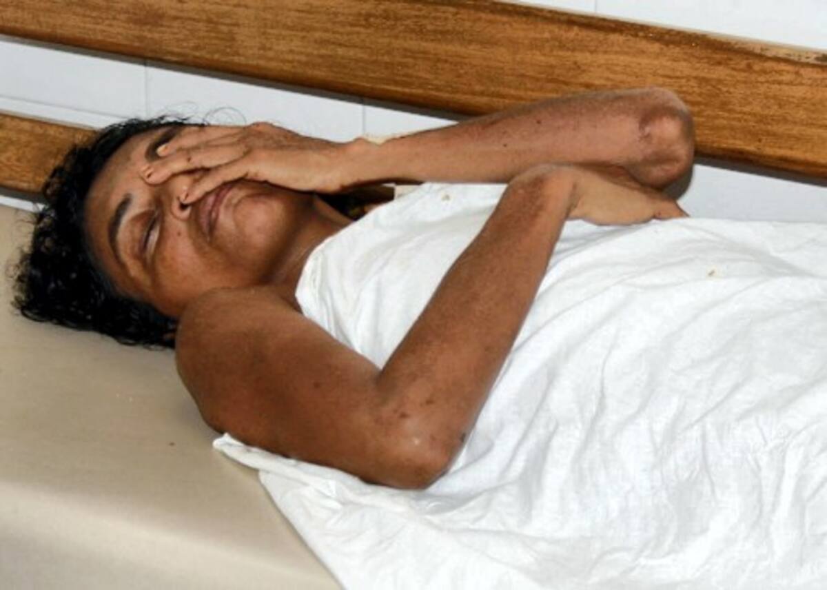 Juana León Rojas permanece hospitalizada en el HUS. MANUEL SANTIAGO PÉREZ/EL UNIVERSAL