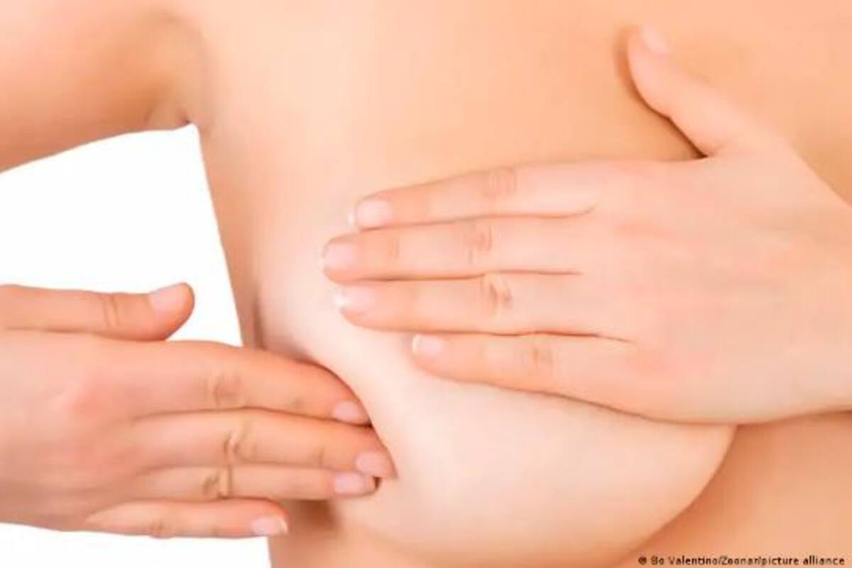 La quimioterapia puede provocar la recaída de cáncer de mama, según estudio