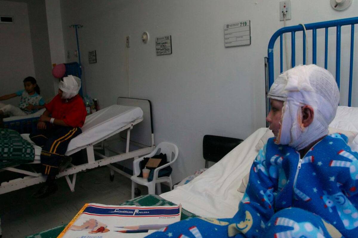 Quemados por pólvora en Colombia: estas son las ciudades con más casos