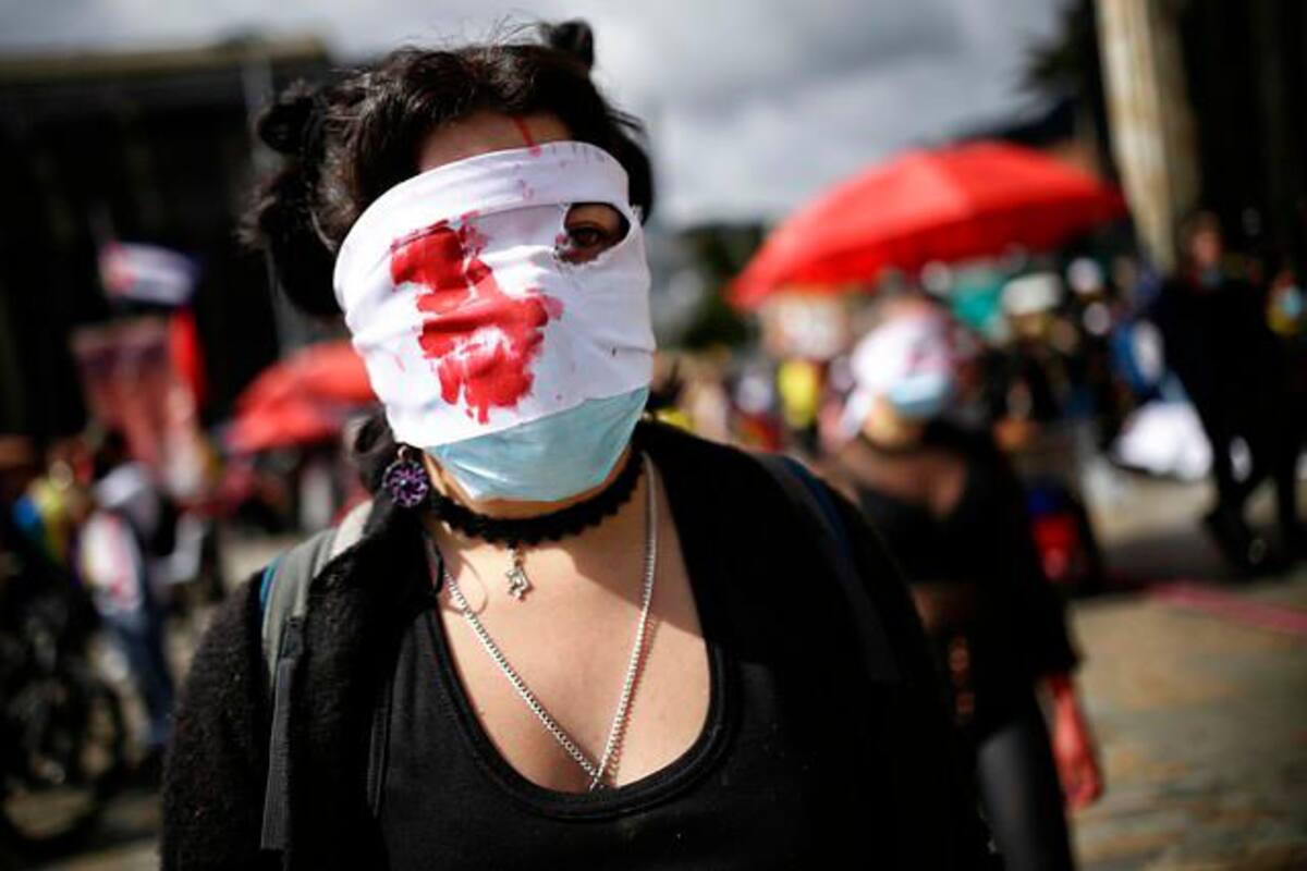 103 personas sufrieron lesiones oculares durante el paro nacional de 2021