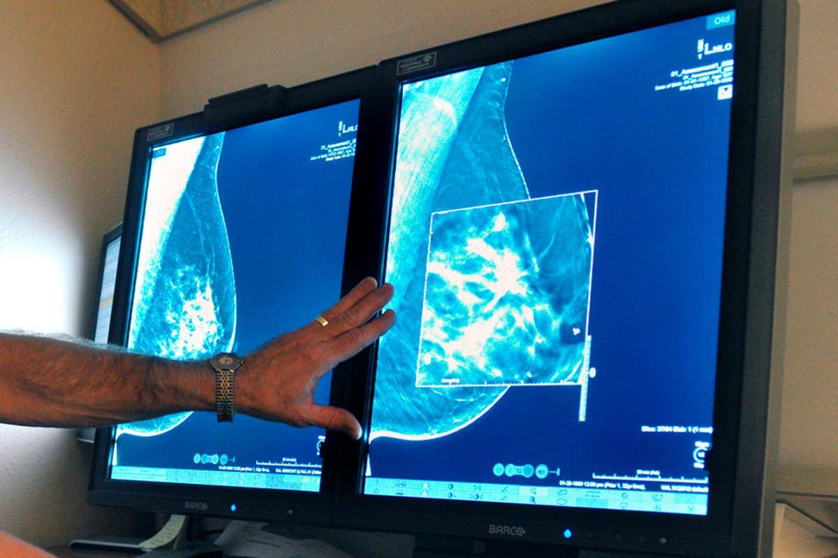 Crisis en México: 86 % de pacientes con cáncer, sin tratamiento