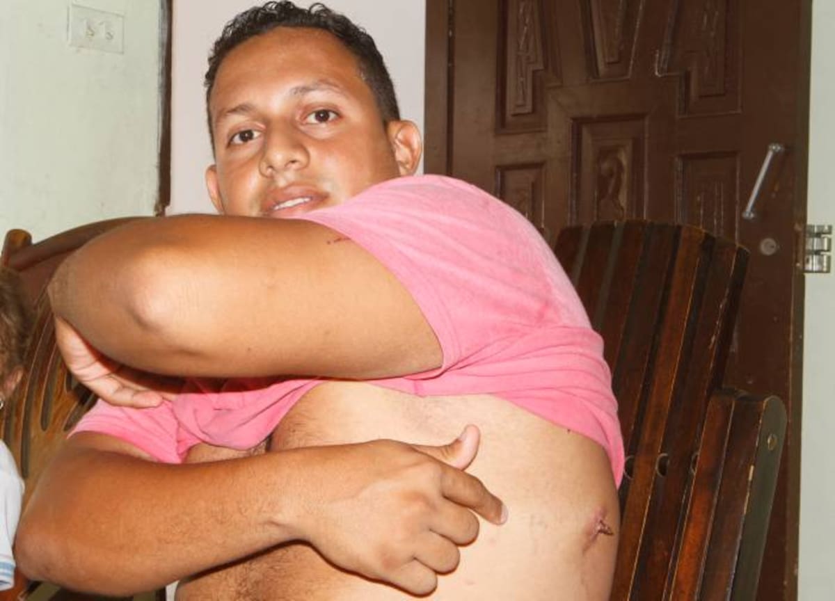 José Manjarrés Canedo dice que el tener un vidrio incrustado en el tórax le ha ocasionado perjuicios como aumentar 20 kilos de peso, perdida de oportunidades laborales y dificultades en su vida marital. JULIO CASTAÑO - EL UNIVERSAL
