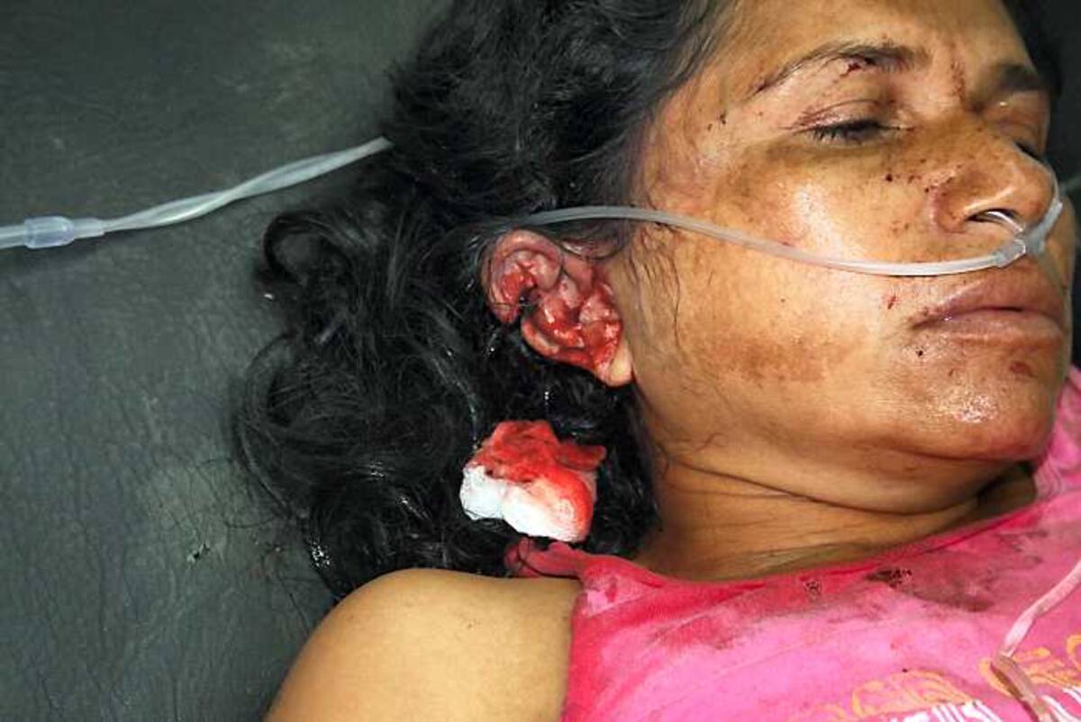 La mujer embarazada, además de lesiones graves en su oreja, puede perder el bebé.