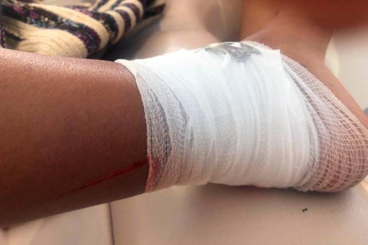 Periodista colombiana herida tras ser golpeada por una lancha en Cholón