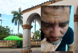 Intolerancia en Turbaco: le pegaron a un ingeniero mientras trabajaba