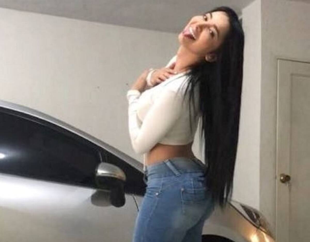 Modelo herida durante ataque a bala. Colprensa.