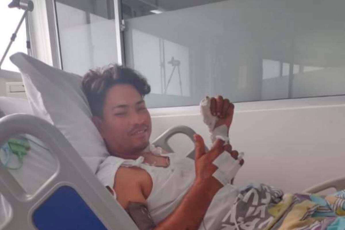 Teletón para joven arjonero que perdió su pierna en accidente