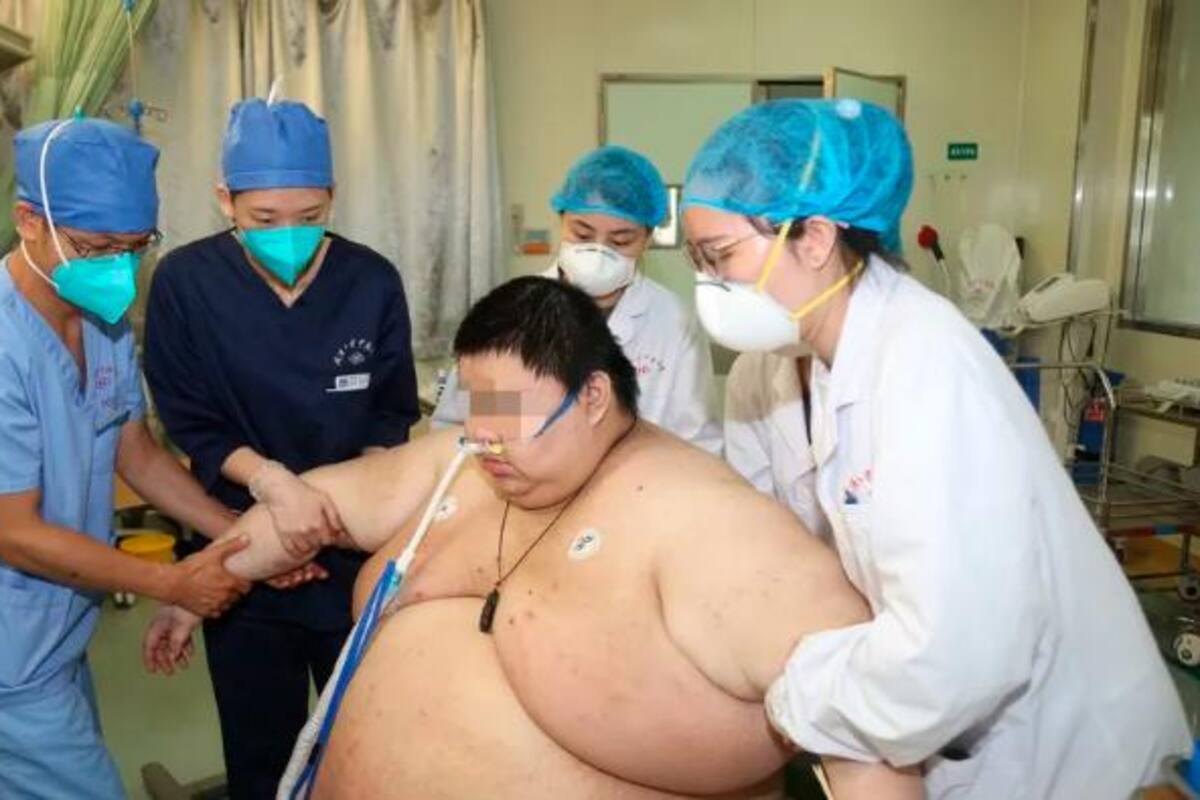 Preocupación en China: más del 50 % de los adultos tienen sobrepeso u obesidad