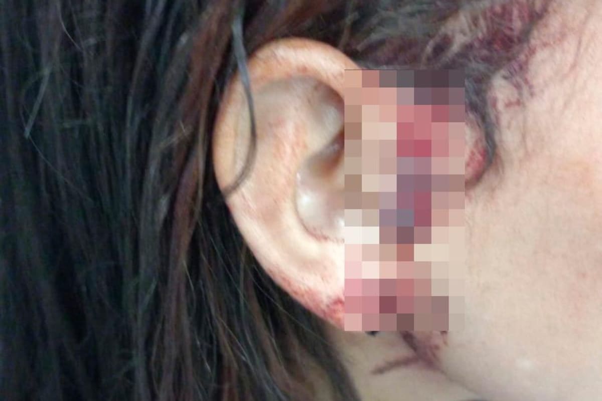 ¡Atroz! Su marido la golpeó con un picahielo en la cabeza y fue capturado