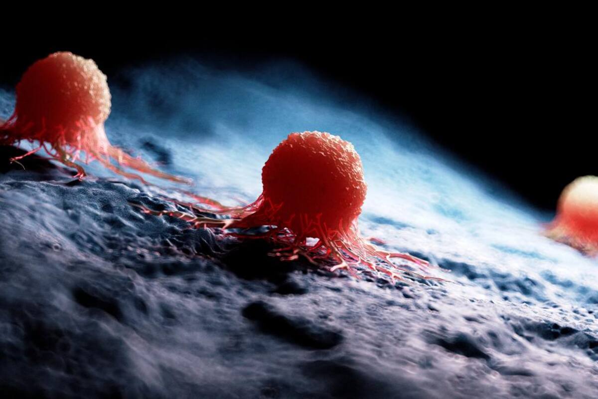 Aprobada nueva terapia contra cáncer colorrectal