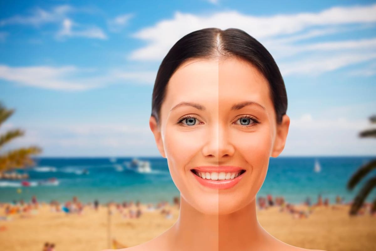 Melasma, léntigos y más afecciones en piel a fin de año