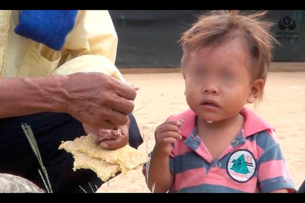 En Colombia han fallecido 141 niños por desnutrición aguda durante 2021