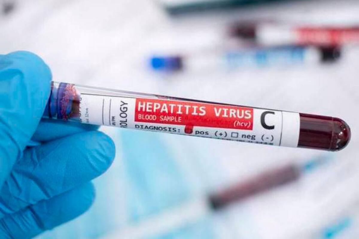 Colombia detecta primer caso de hepatitis aguda de origen desconocido