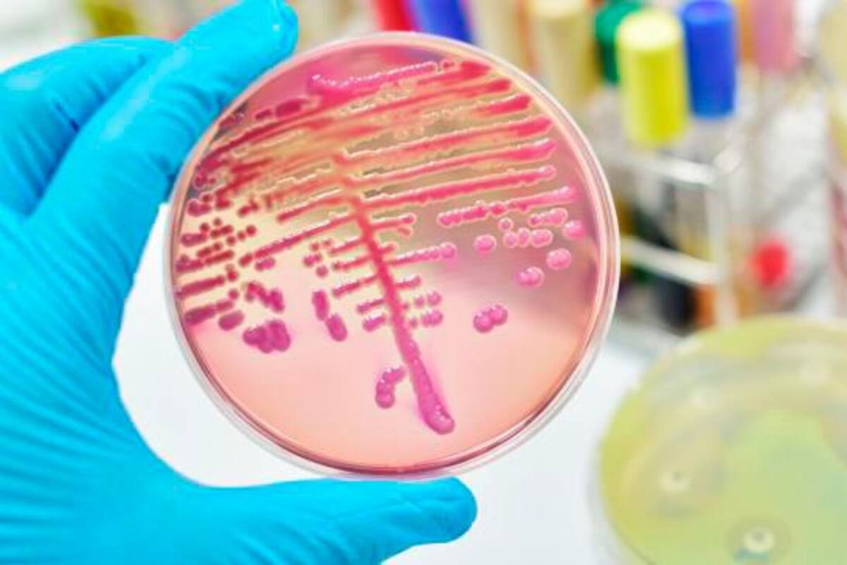 Klebsiella: así es la superbacteria que registra brote en Colombia