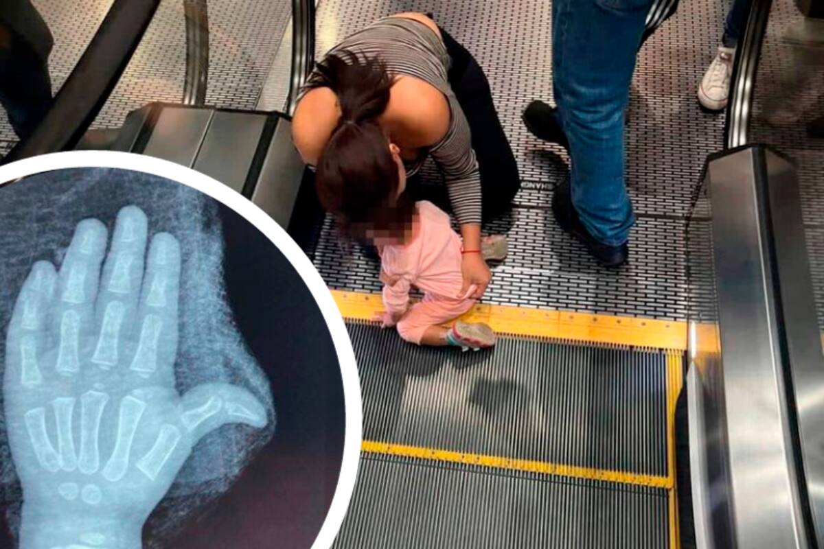 Niña casi pierde sus dedos tras quedarse atorada en una escalera eléctrica